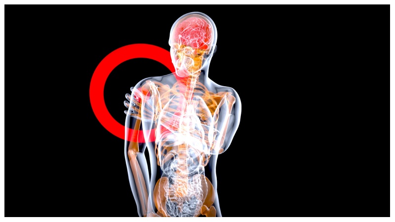 How Tadicurange Disease Affects the Body